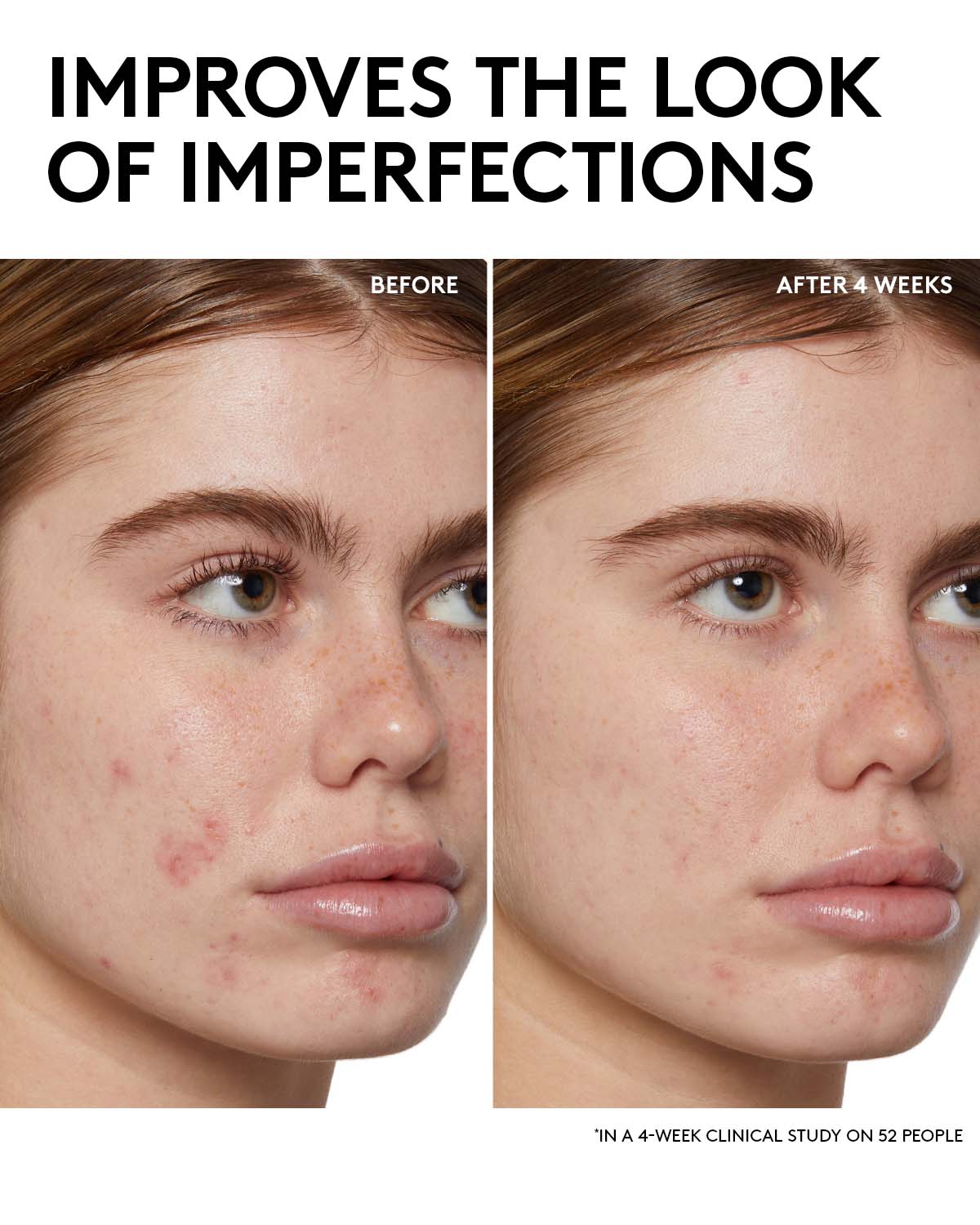 Cherry Dub BHA Toner with Salicylic Acid + Aloe Juice